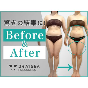 ドクタービセア フォーカスネオ 美容機器 美顔器　痩身　エステ サロン　小顔 フォーカスネオ※現在生産終了 | 株式会社Dr.Visea/ドクタービセア
