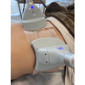 つくば初☆最新式360度脂肪冷却サイズダウン可能！某クリニック