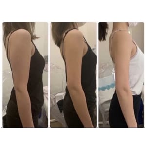 12℃脂肪冷却×世界初！次世代EMS寝てるだけで約2万回の腹筋効果