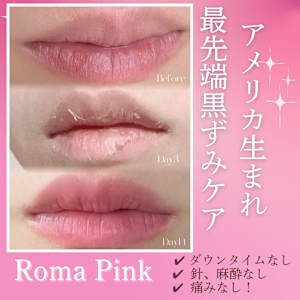 渋谷BELZE【脱毛・毛穴洗浄・フェムケア・ローマピンク】(シブヤ