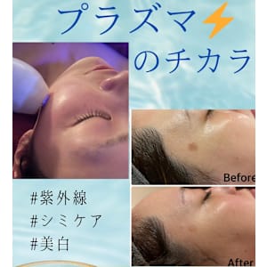 人気メニュー♪♪【毛穴ごっそり洗浄】ハイドラシャイン毛穴洗浄+極上