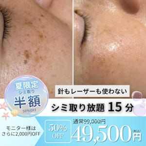 夏限定】剝がすシミ取り｜半額～ | プリンセスエステティックサロン