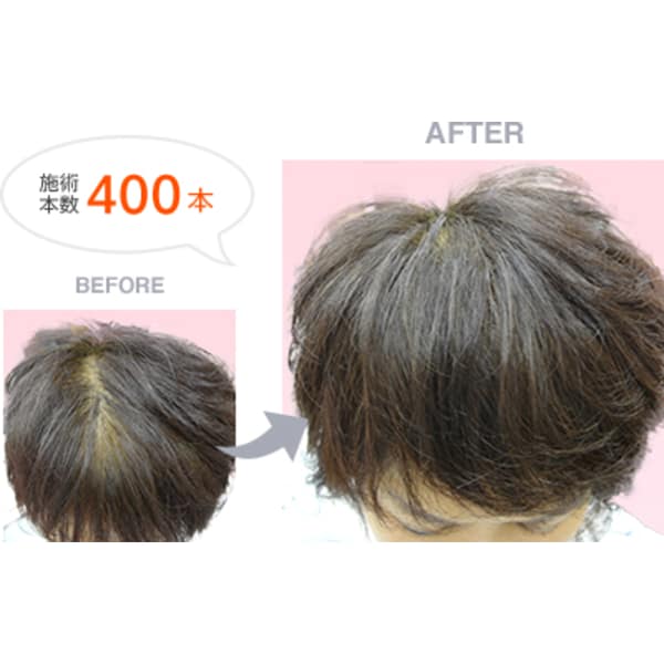 人気メニュー！ボリュームアップ増毛400本