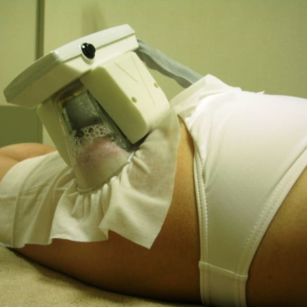 人気!脂肪冷却2箇所+強圧加減が選べるリンパマッサージ付きコース