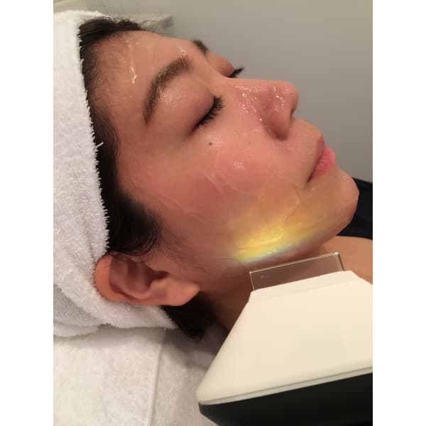 NEWクーポン♪【美肌脱毛トライアル☆】「お顔全体」1回 回数:1回