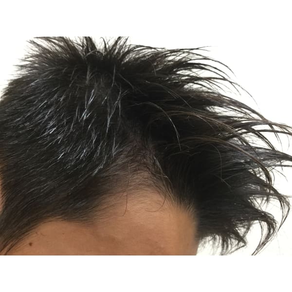 カット（A）スキャルプ豪華コース（F）メニュー 3回 33000