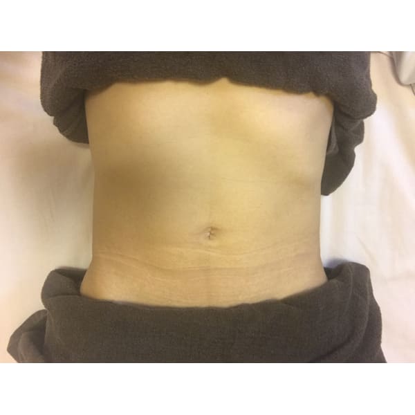 チネイザン(氣内臓療法)腹部マッサージ  120分  お着替付  11880円