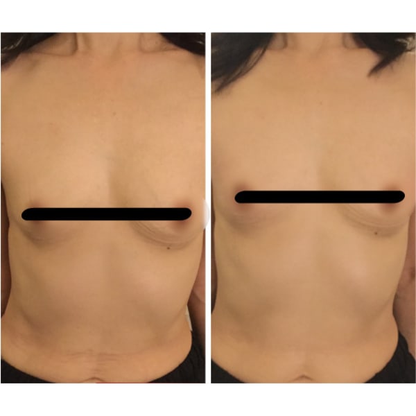 中学生〜大学生まで限定価格!!「おむねケア」バストアップはもちろん大きい胸をなんとかしたい悩みまで