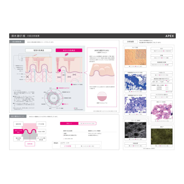 パーソナルトリートメント