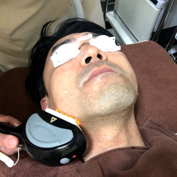 【リピート用】メンズ ヒゲ脱毛