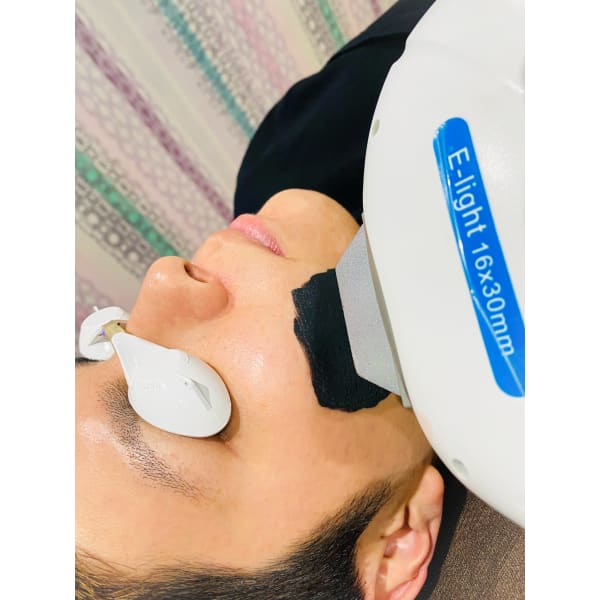 さよなら いちご鼻 毛穴詰まり ニキビとニキビ跡 レガオス梅田店 レガオスウメダテン のこだわり特集 エステサロンを予約するなら楽天ビューティ