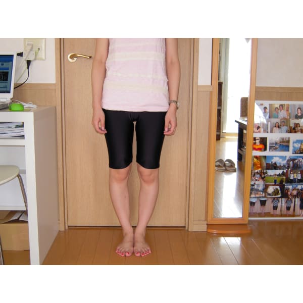 【ネット予約限定】O脚矯正5回券 改善まで徹底フォロー。美脚を目指す方