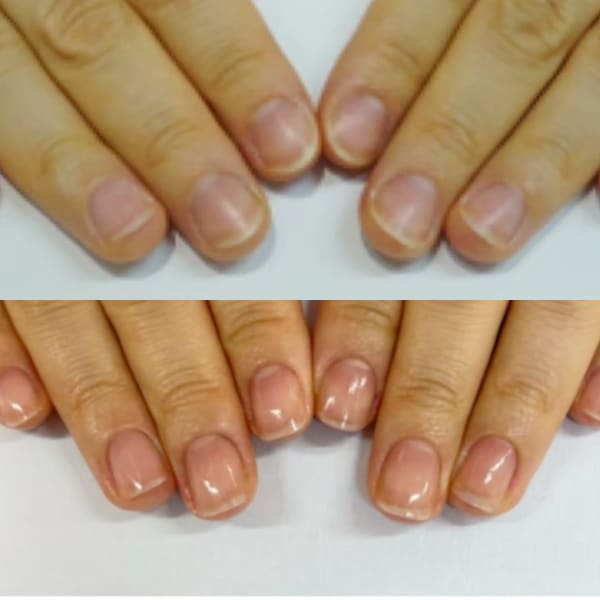 【コンプレックス卒業をめざす】最強のネイルケアコース 3か月サポートコース(全8回)