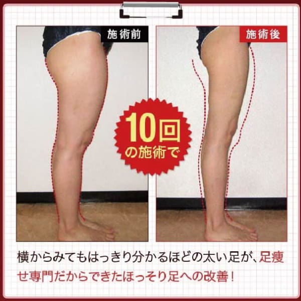 フォーレディ式皮下脂肪燃焼/美脚エステ体験（60分/施術）