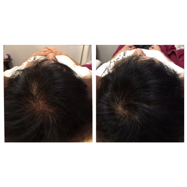 【初回】増毛＋カット