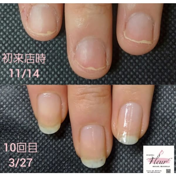 【まずは体験から】最強のネイルケアお試しコース