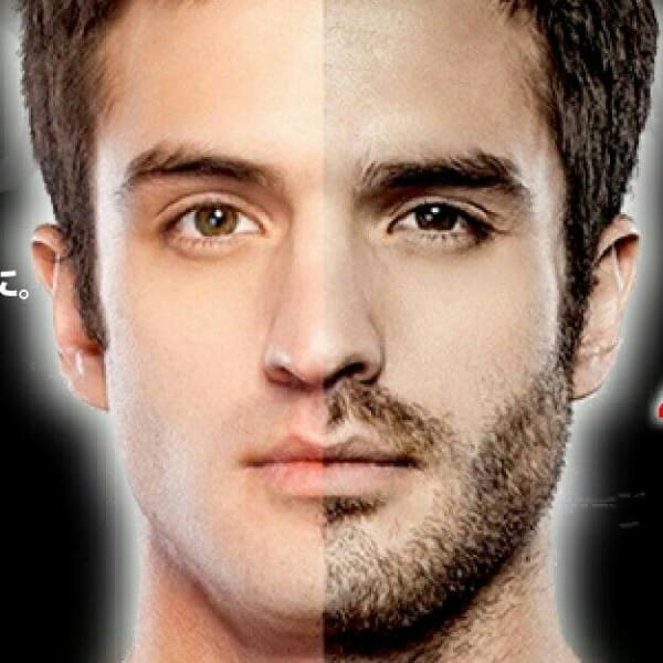 【1月限定*カミソリ負け卒業】ヒゲ脱毛（顎・頬・鼻下・口下）全部位　¥1000