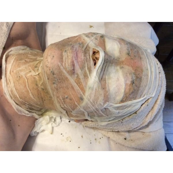 5daysハーブピールトリートメント（剥離あり）