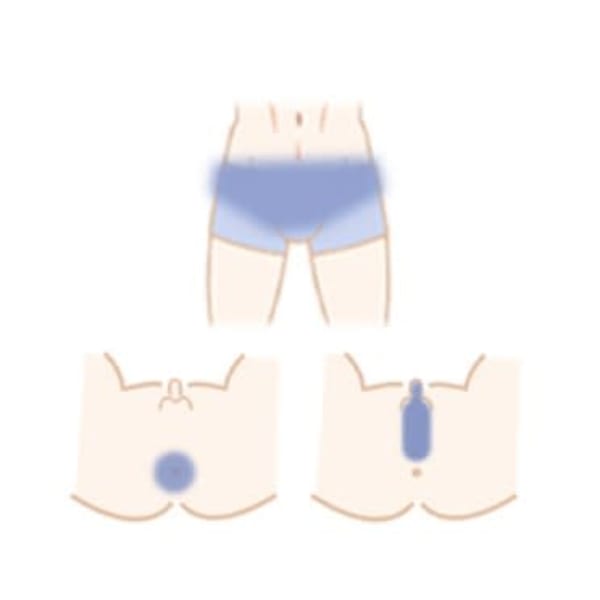 【気になるムレに◎】vio脱毛_全パーツ_5,500円