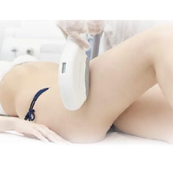 コラーゲン美肌脱毛（VIO脱毛）