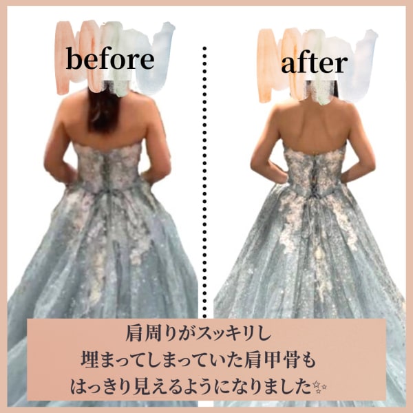 ＜A＞[目標体重まで通い放題]10kgまで66,000円～＆補償３年付き！ 無料カウンセリング.