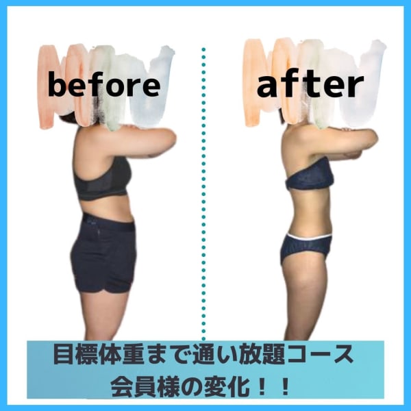 <A>【10kg減量まで¥66,000~】目標体重まで通い放題★リバウンド補償付★初回相談!