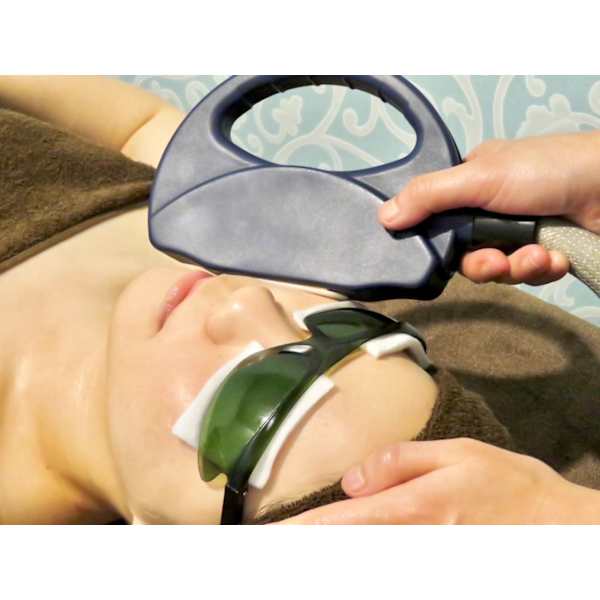 FACE全脱毛【1年6回】29800円　限定20名　医療提携　※免許所持者が施術します