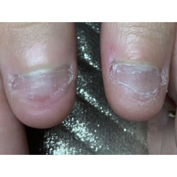 【深爪矯正】美爪目指してジェル補強♪　120分　¥6980