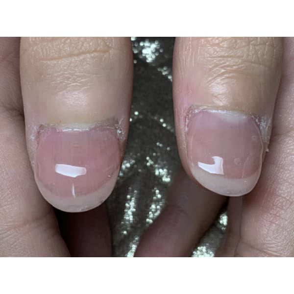 【学割U24】深爪矯正美爪ジェル補強♪120分　¥5980