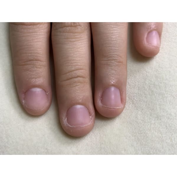 【深爪矯正】美爪目指してジェル補強♪　120分　¥7980