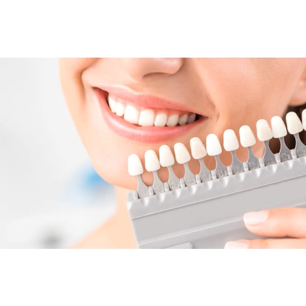 【セルフホワイトニング】気になる歯の黄ばみを解消★初回のお客様限定★￥1,000！