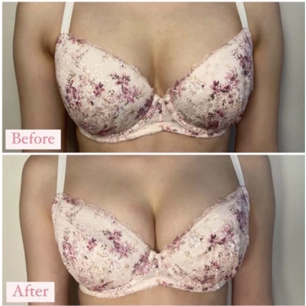 【ふっくらボリューム谷間へ☆】光バストUP体験 1回！　16周年特別価格！