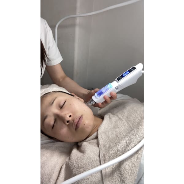ごほう美肌再生エステ【医療用幹細胞上清液使用】