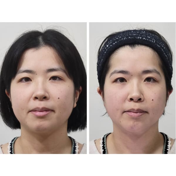 【ご新規】人気No.1／若々しい見た目と自律神経の改善★美容小顔矯正+自律神経整体 150分★