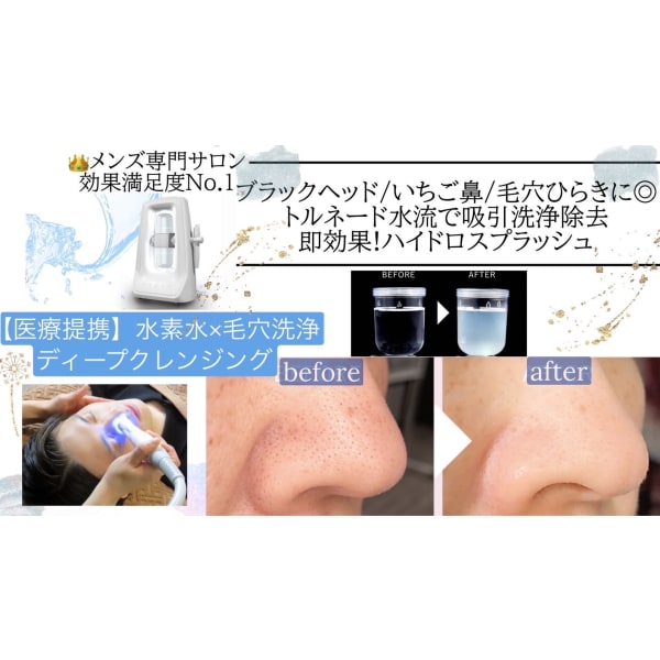【当店人気No.1】最新毛穴レス水素ピーリング毛穴洗浄&徹底掃除!モテ肌☆