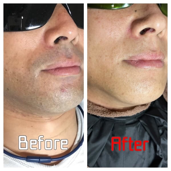 【初回限定】【全体６箇所】ひげ★６２％OFF