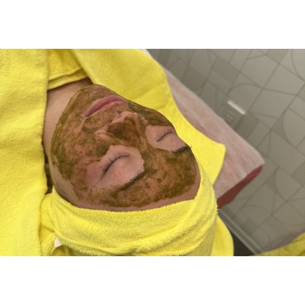 【今だけフェイシャルキャンペーン☆】ハーブピーリング