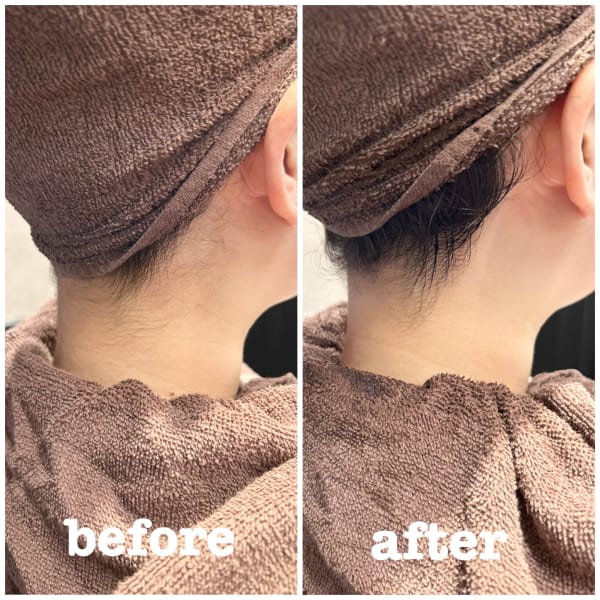 【うなじ美人】デザインカウンセリング+襟足シェービング+脱毛　30分 ¥5500