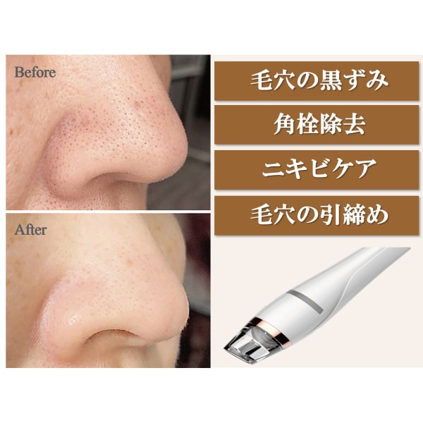 【平日限定クーポン】肌質改善80分　毛穴洗浄＋リフトアップエステ￥18300→