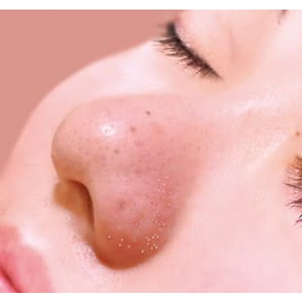 【皮脂汚れケアに】毛穴汚れ皮脂スッキリ