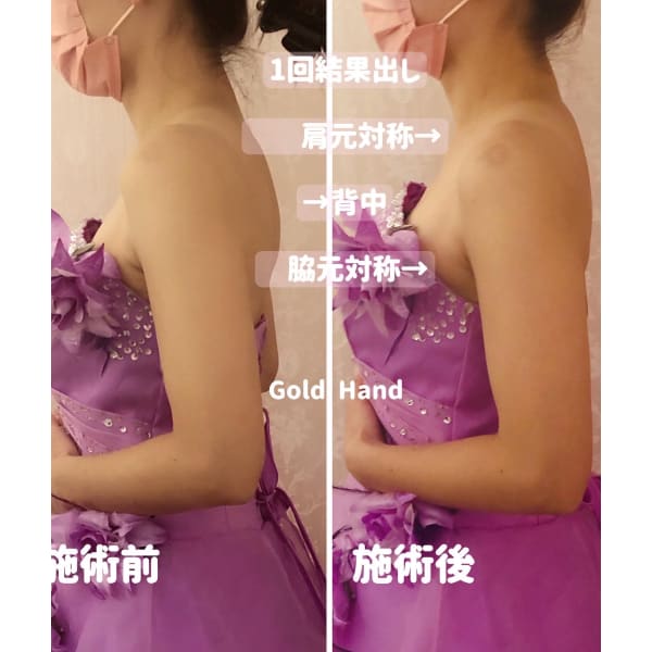 ★ブライダル感動体験コース綺麗になる魔法720°痩身GET!肩甲骨 鎖骨60分体験