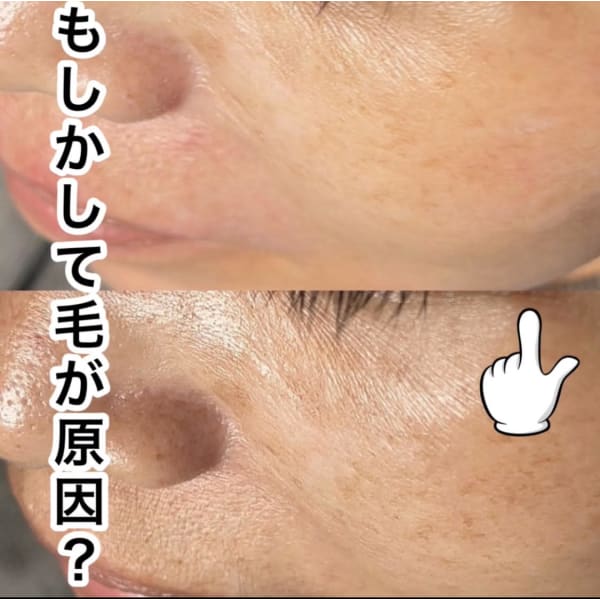 国産無添加、低温のマリムーブフェイシャルWAXで褒められ素肌に★
