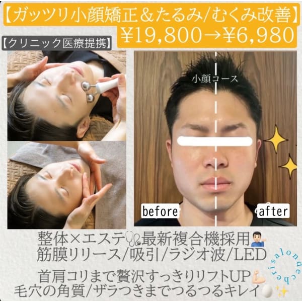人気No.2【ガッツリ小顔矯正】筋膜リリース/吸引/ラジオ波/首肩コリ強リンパ