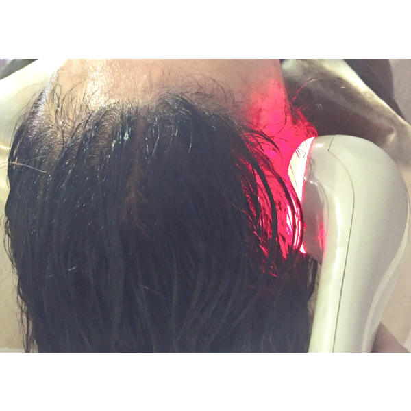 【初回限定価格】カット・シャンプー・毛根活力白髪育毛アデノブーストスパ　コース（ブロー込み）