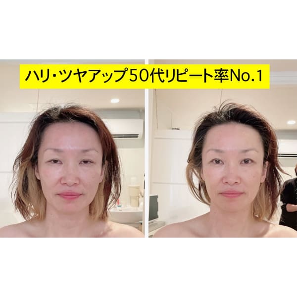 取り戻したいハリとツヤ！肌土台の引き上げに【肌質改善プログラム】