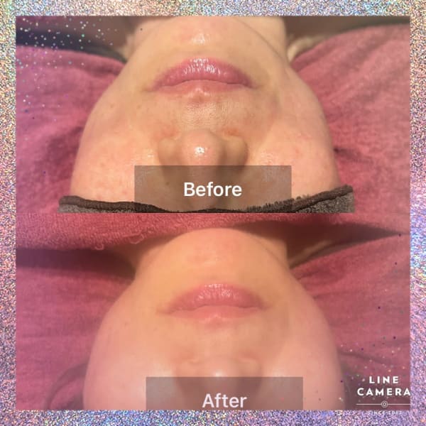 お化粧したまま お気軽に小顔リフトUP！『小顔矯正 』＋手足・デコルテのリンパ流し10分