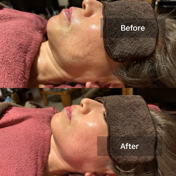 『日本初エビデンス所得の小顔美顔矯正プレミアム110分』リフトアップした小顔に！