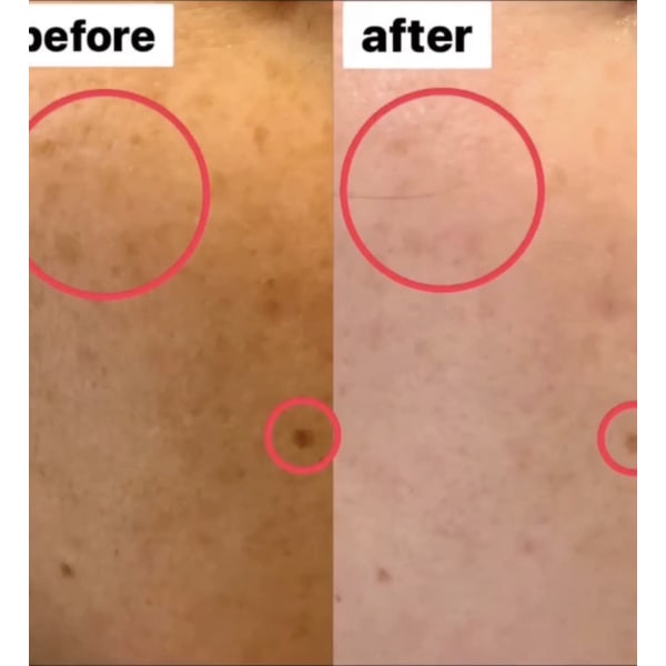 【新規限定】日焼けリセット《シミ・くすみ・日焼け》美白ホワイトニングコース