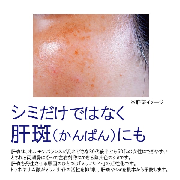 【超人気】フェイシャル肝斑ケアコース