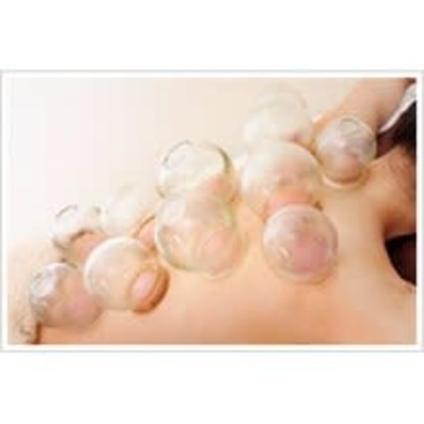 吸い玉(カッピング)20分¥2,500